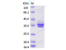 Sino Biological Recombinant Dermatophagoides pteronyssinus Der p 1 Protein