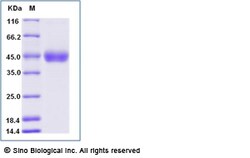 Sino Biological Recombinant Rabbit CD64A Protein (His Tag), Quantity: Each