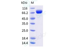 Sino Biological Recombinant Mouse TL1A/TNFSF15 Protein (Trimer, His Tag),