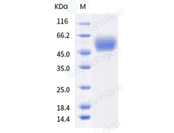 Sino Biological Recombinant Chinese hamster Phospholipase A2 group XV/PLA2G15