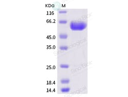 Sino Biological Recombinant Mouse Siglec-15 Protein (rFc Tag), Quantity: