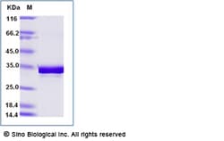 Sino Biological Recombinant Mouse FGL1 Protein (His Tag), Quantity: Each