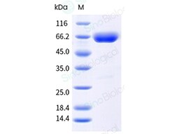 Sino Biological Recombinant Mouse ALPPL2/ALPG Protein (His Tag), HPLC-verified,