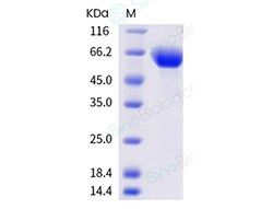 Sino Biological Recombinant Mouse ROR1 Protein (His Tag), HPLC-verified,