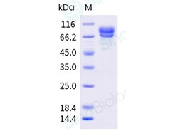 Sino Biological Recombinant Mouse Desmocollin 2/DSC2 Protein (ECD, His