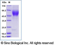 Sino Biological Recombinant Mouse Nectin-1/PVRL1 Protein (ECD, His Tag),