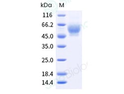 Sino Biological Recombinant Mouse MAdCAM-1 Protein (ECD, His Tag), HPLC-verified,