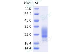 Sino Biological Recombinant Mouse NKG2D Protein (ECD, His Tag), Quantity: