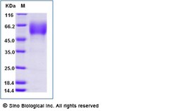 Sino Biological Recombinant Mouse CD47 Protein (ECD, hFc Tag), Quantity: