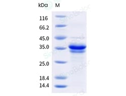 Sino Biological Recombinant Mouse SOX2 Protein (His Tag), Quantity: Each