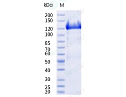 Sino Biological Recombinant Mouse CEACAM-5/CD66e Protein (His & AVI Tag),