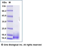 Sino Biological Recombinant Mouse Ly-6A/E (Sca-1) Protein (His Tag), Quantity: