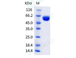 Sino Biological Recombinant Mouse LAG-3 Protein (His & AVI Tag), Biotinylated,