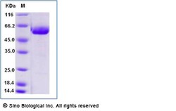 Sino Biological Recombinant Mouse IL-4R Protein (ECD, hFc Tag), HPLC-verified,