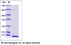 Sino Biological C5a Protein, Mouse, Recombinant, Biotinylated, Quantity: