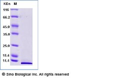 Sino Biological C5a Protein, Mouse, Recombinant, Biotinylated, Quantity: