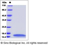Sino Biological Recombinant Mouse MDC/CCL22 Protein (His Tag), Quantity: