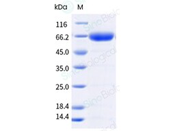Sino Biological Recombinant Mouse CD70/CD27 Ligand Protein (His Tag), Trimer,