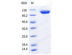 Sino Biological Recombinant Mouse CD70/CD27 Ligand Protein (mFc Tag), HPLC-verified,