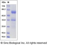 Sino Biological Recombinant Mouse Flt3 Ligand/FLT3LG Protein (hFc Tag),