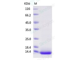 Sino Biological Recombinant Mouse IL-4 Protein, Quantity: Each of 1