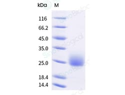 Sino Biological Recombinant Mouse IL-3 Protein, HPLC-verified, Quantity: