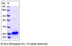Sino Biological Recombinant Mouse IL-2 Protein, Quantity: Each of 1