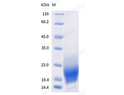 Sino Biological Recombinant Mouse GM-CSF/CSF2 Protein, Quantity: Each of