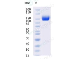 Sino Biological Recombinant Mouse VEGFR1/FLT1 Protein (ECD, His Tag), Quantity: