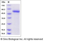 Sino Biological Recombinant Mouse BACE2 Protein (His Tag), Quantity: Each