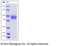 Sino Biological Recombinant Mouse B7-H3 Protein (His Tag), Amine-Labeled
