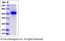 Sino Biological Recombinant Mouse APRIL/TNFSF13 Protein (hFc Tag), Quantity:
