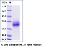 Sino Biological Recombinant Mouse DICR/CLEC4A Protein (ECD, His Tag), Quantity: