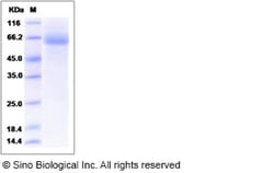 Sino Biological Recombinant Mouse Fc epsilon RI Protein (hFc Tag), Quantity: