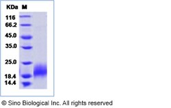 Sino Biological Recombinant Mouse PDGF-B Protein (His Tag), Quantity: Each