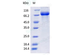 Sino Biological Recombinant Mouse Transferrin Receptor/TFR1/CD71 Protein