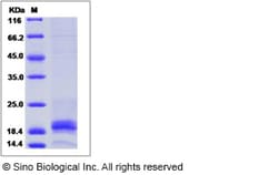Sino Biological Recombinant Mouse IFN gamma Protein, Quantity: Each of