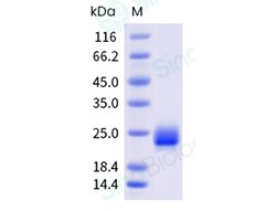 Sino Biological Recombinant Mouse Interferon alpha 4/IFNA4 Protein (His