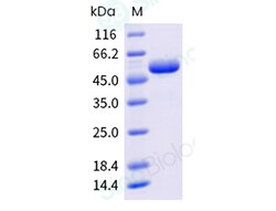 Sino Biological Recombinant Mouse Interferon alpha 4/IFNA4 Protein (hFc