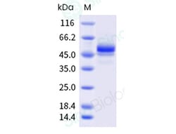 Sino Biological Recombinant Mouse Carbonic Anhydrase IX/CA9 Protein (His