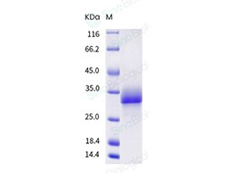 Sino Biological Recombinant Mouse Adiponectin Protein (His Tag), Quantity: