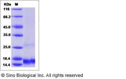 Sino Biological Recombinant Mouse MCP-3/CCL7 Protein (His Tag), Quantity: