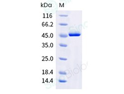 Sino Biological Recombinant Human CK-MB/CKMB Protein, Quantity: Each of