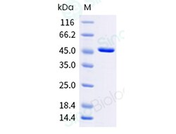 Sino Biological Recombinant Human Creatine Kinase Muscle/CKM Protein, Quantity: