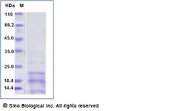 Sino Biological Recombinant Mouse CD63 Protein, HPLC-verified, Quantity: