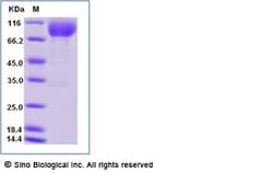 Sino Biological Recombinant Mouse NGL-1/LRRC4C Protein (ECD, His Tag),