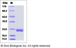 Sino Biological Recombinant Mouse Interferon alpha 1/IFNA1 Protein (His