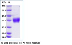 Sino Biological Recombinant Mouse IL-20R beta/IL-20RB Protein (ECD, His