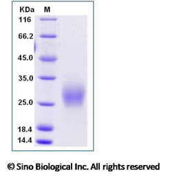 Sino Biological Recombinant Mouse CTLA-4 Protein (His Tag), Amine-Labeled