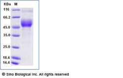 Sino Biological Recombinant Mouse ICOS Protein (ECD, hFc & AVI Tag), Biotinylated,